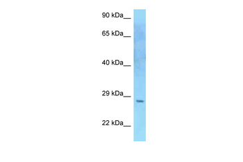 SOCS2 Rabbit Polyclonal Antibody