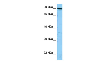 FYB1 Rabbit Polyclonal Antibody