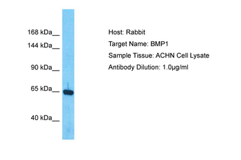 BMP1 Rabbit Polyclonal Antibody