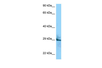 CD151 Rabbit Polyclonal Antibody
