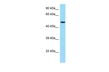 SLC19A2 Rabbit Polyclonal Antibody