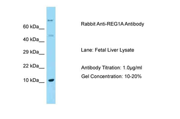 REG1A Rabbit Polyclonal Antibody
