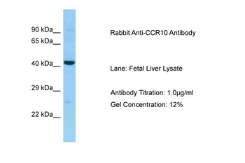 CCR10 Rabbit Polyclonal Antibody