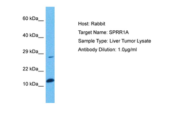SPRR1A Rabbit Polyclonal Antibody