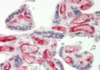 FCGR2B Rabbit Polyclonal Antibody