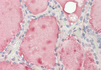 FCGR2B Rabbit Polyclonal Antibody