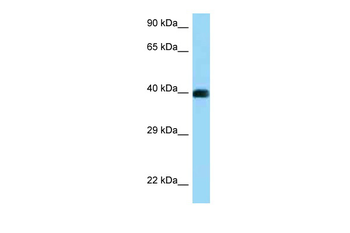 CD72 Rabbit Polyclonal Antibody