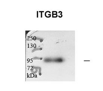ITGB3 Rabbit Polyclonal Antibody
