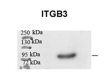 ITGB3 Rabbit Polyclonal Antibody
