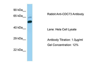 CDC73 Rabbit Polyclonal Antibody