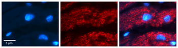 PPP1R15A Rabbit Polyclonal Antibody