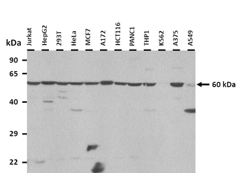 CYP4F2 Rabbit Polyclonal Antibody