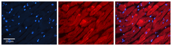 RAB11A Rabbit Polyclonal Antibody