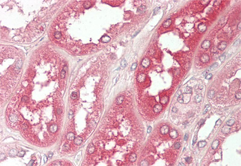 YES1 Rabbit Polyclonal Antibody
