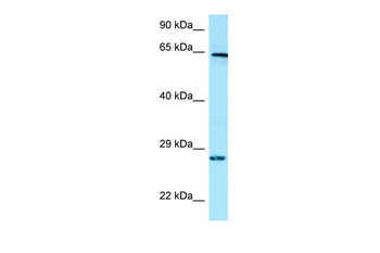 ICK Rabbit Polyclonal Antibody