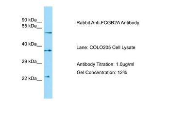 FCGR2A Rabbit Polyclonal Antibody