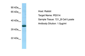 PEX14 Rabbit Polyclonal Antibody