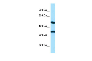 CASQ2 Rabbit Polyclonal Antibody