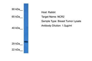 NCR2 Rabbit Polyclonal Antibody