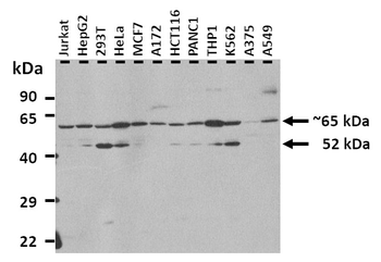 LILRB2 Rabbit Polyclonal Antibody