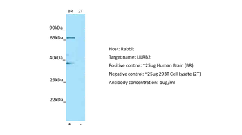 LILRB2 Rabbit Polyclonal Antibody