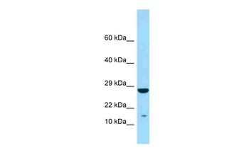 ITGA2B Rabbit Polyclonal Antibody