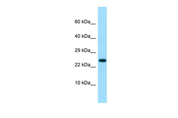 IL19 Rabbit Polyclonal Antibody
