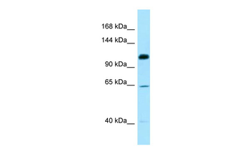 SMC6 Rabbit Polyclonal Antibody