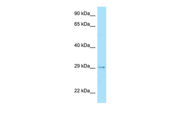 STC2 Rabbit Polyclonal Antibody
