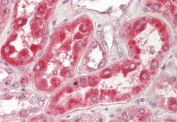 GCSH Rabbit Polyclonal Antibody