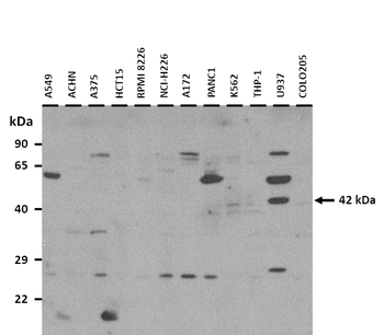 NEU2 Rabbit Polyclonal Antibody