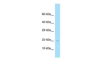 NDUFS4 Rabbit Polyclonal Antibody
