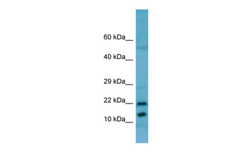 RPL11 Rabbit Polyclonal Antibody