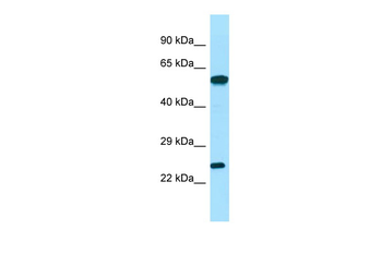DGUOK Rabbit Polyclonal Antibody