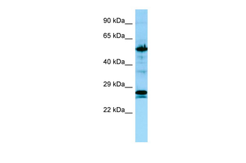 KRT6A Rabbit Polyclonal Antibody