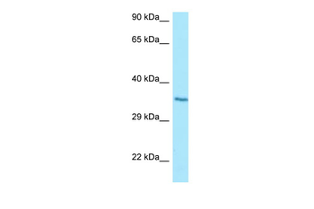 HYI Rabbit Polyclonal Antibody