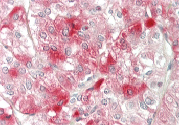 ELOVL6 Rabbit Polyclonal Antibody