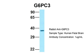 G6PC3 Rabbit Polyclonal Antibody