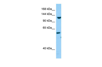 TLL1 Rabbit Polyclonal Antibody