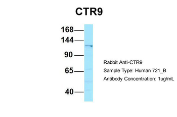 CTR9 Rabbit Polyclonal Antibody