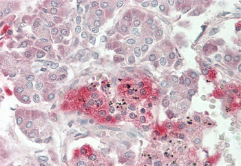 ADM2 Rabbit Polyclonal Antibody