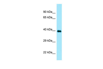 DOC2A Rabbit Polyclonal Antibody