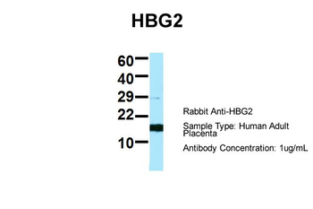 HBG2 Rabbit Polyclonal Antibody