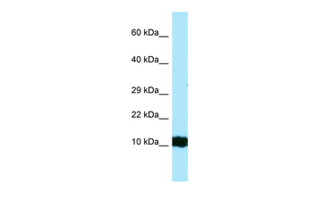 HBG2 Rabbit Polyclonal Antibody