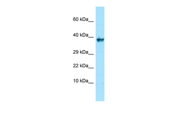 NPR3 Rabbit Polyclonal Antibody