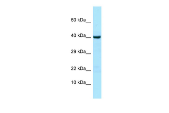 NPR3 Rabbit Polyclonal Antibody