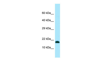 UBE2V2 Rabbit Polyclonal Antibody
