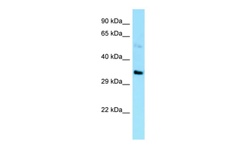 EBNA1BP2 Rabbit Polyclonal Antibody