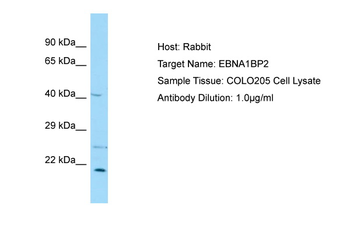 EBNA1BP2 Rabbit Polyclonal Antibody