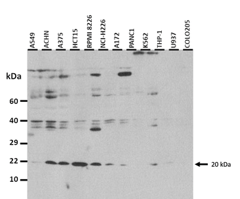 IL26 Rabbit Polyclonal Antibody